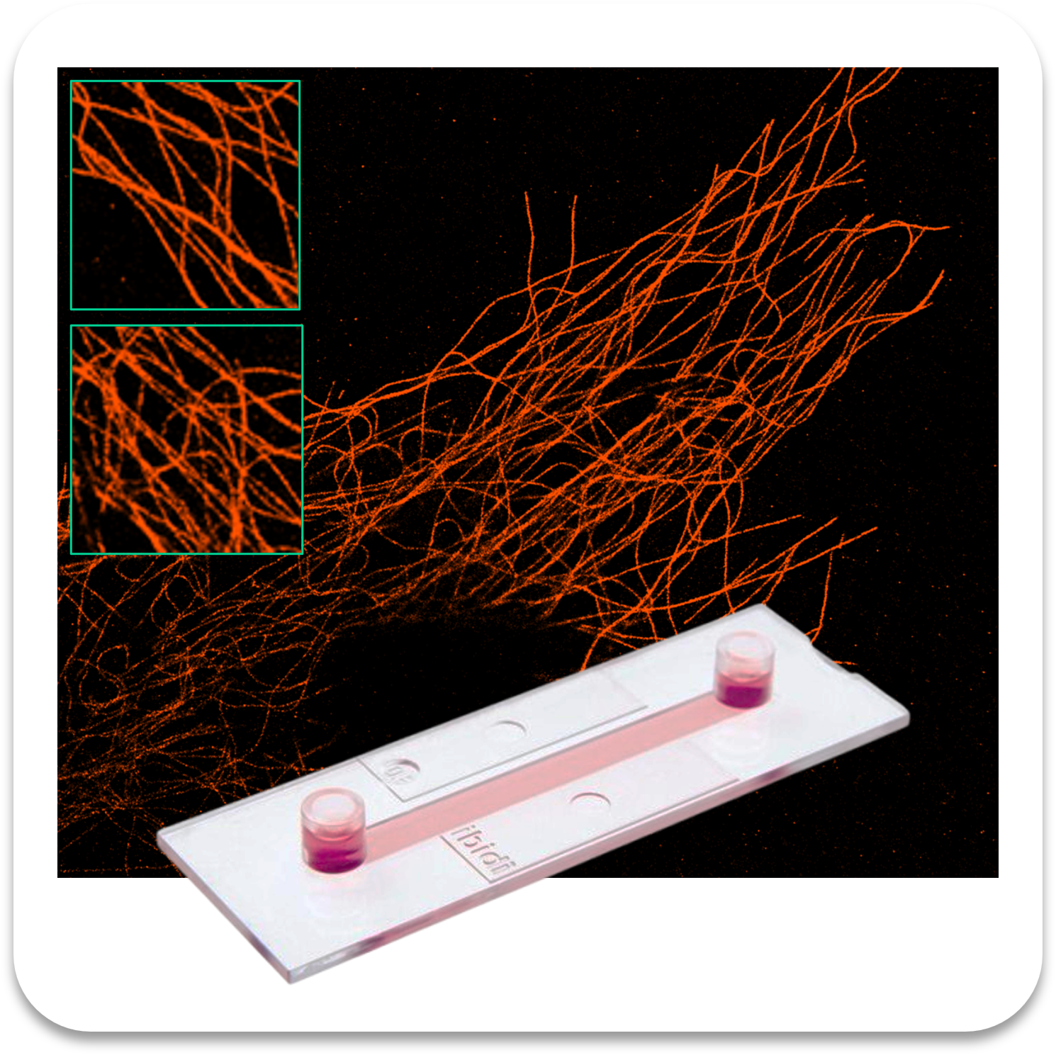 Abbelight safe sample tubulin af647