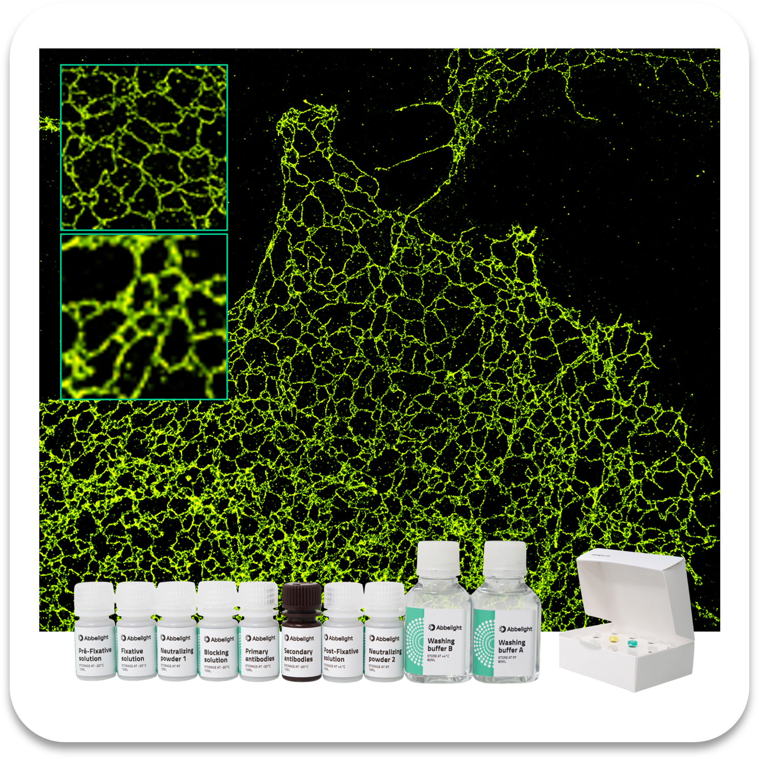 Abbelight Smart Staining Kit Endoplasmic Reticulum protein with AF647