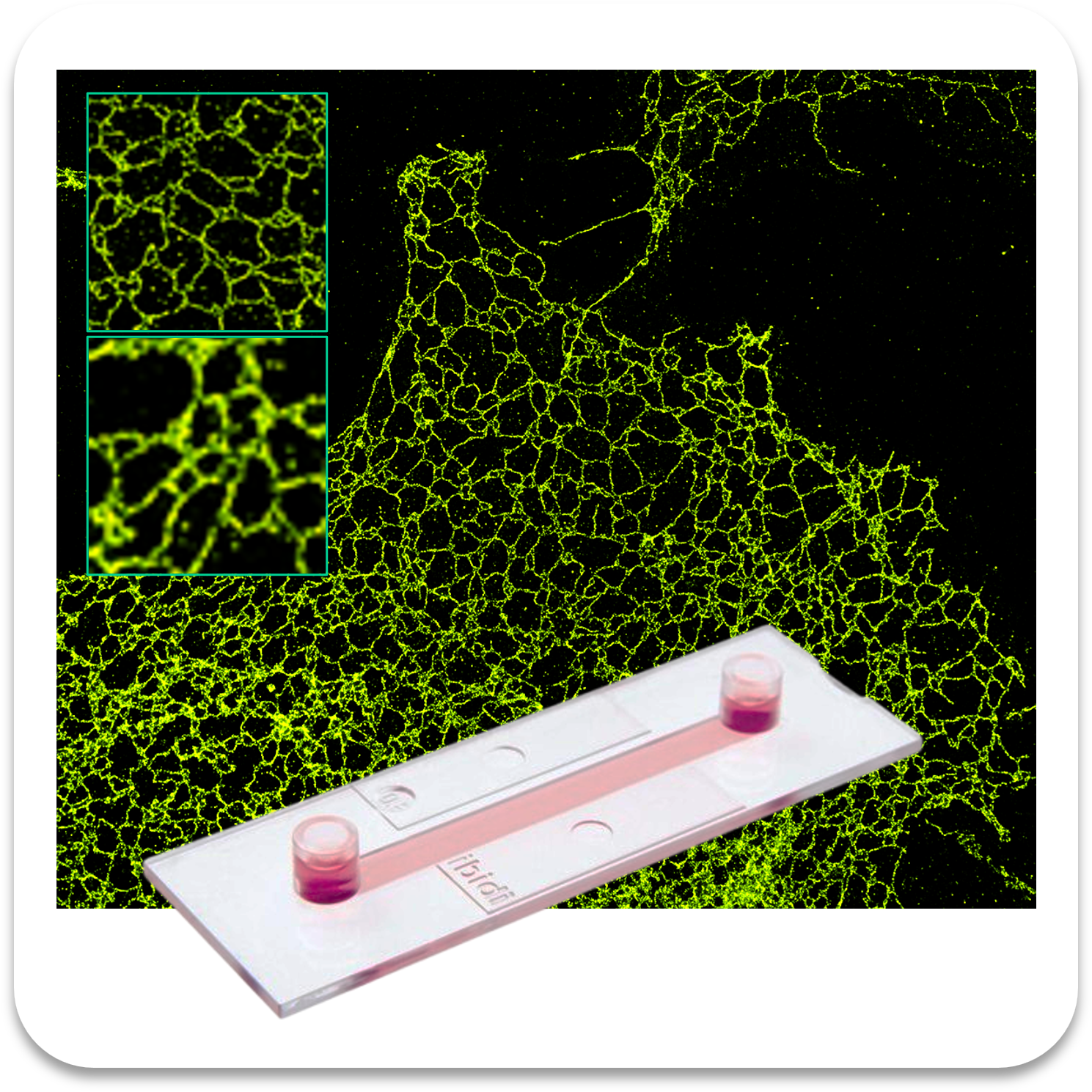 Abbelight safe sample endoplasmic reticulum af647