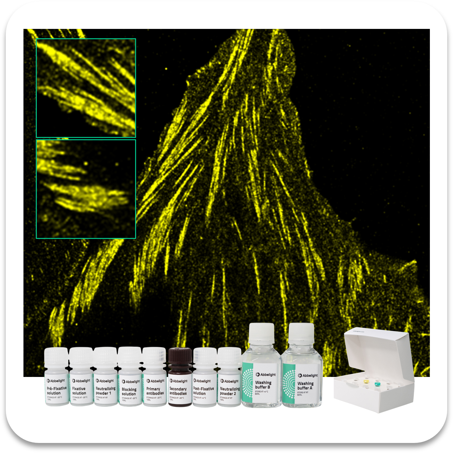 Abbelight Smart Staining Kit Paxillin protein with AF647
