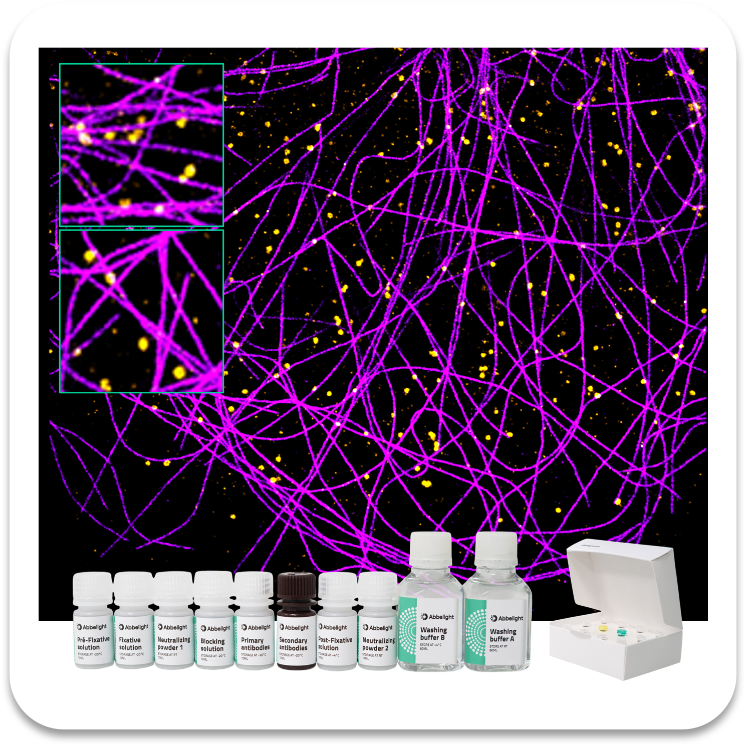 Abbelight Smart Staining Kit Alpha-Tubulin protein with AF647 and Clathrin protein with CF680