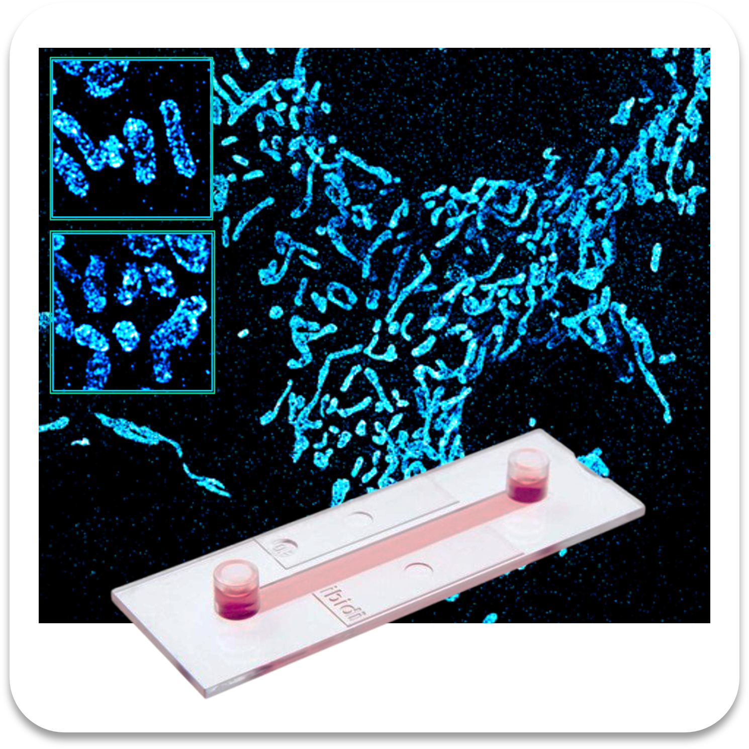 Abbelight safe sample mitochondria af647