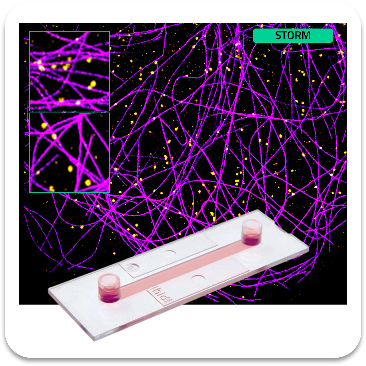 Abbelight safe sample tubulin af647 clathrin cf680