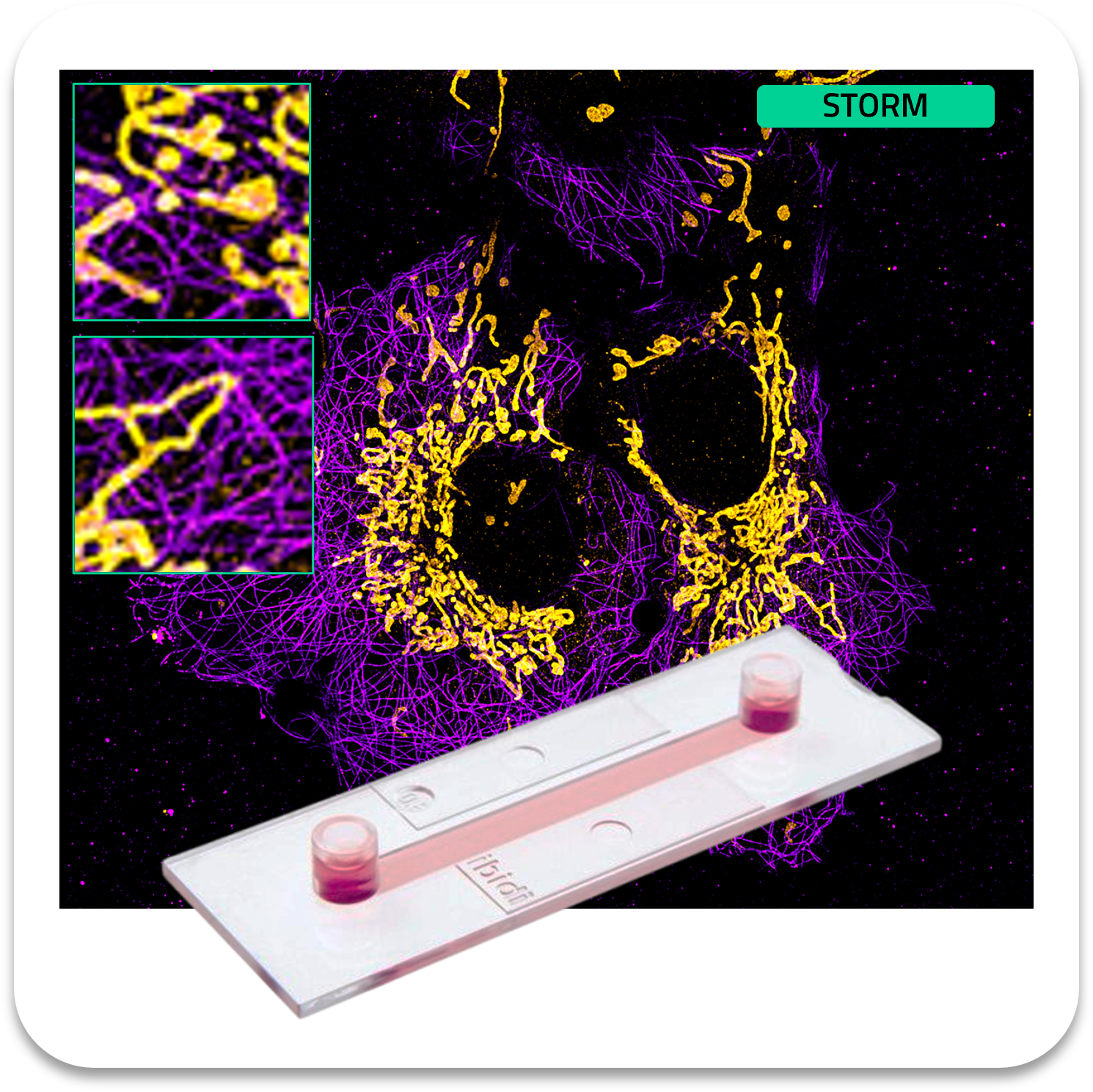 Abbelight safe sample tubulin af647 mitochondria cf680