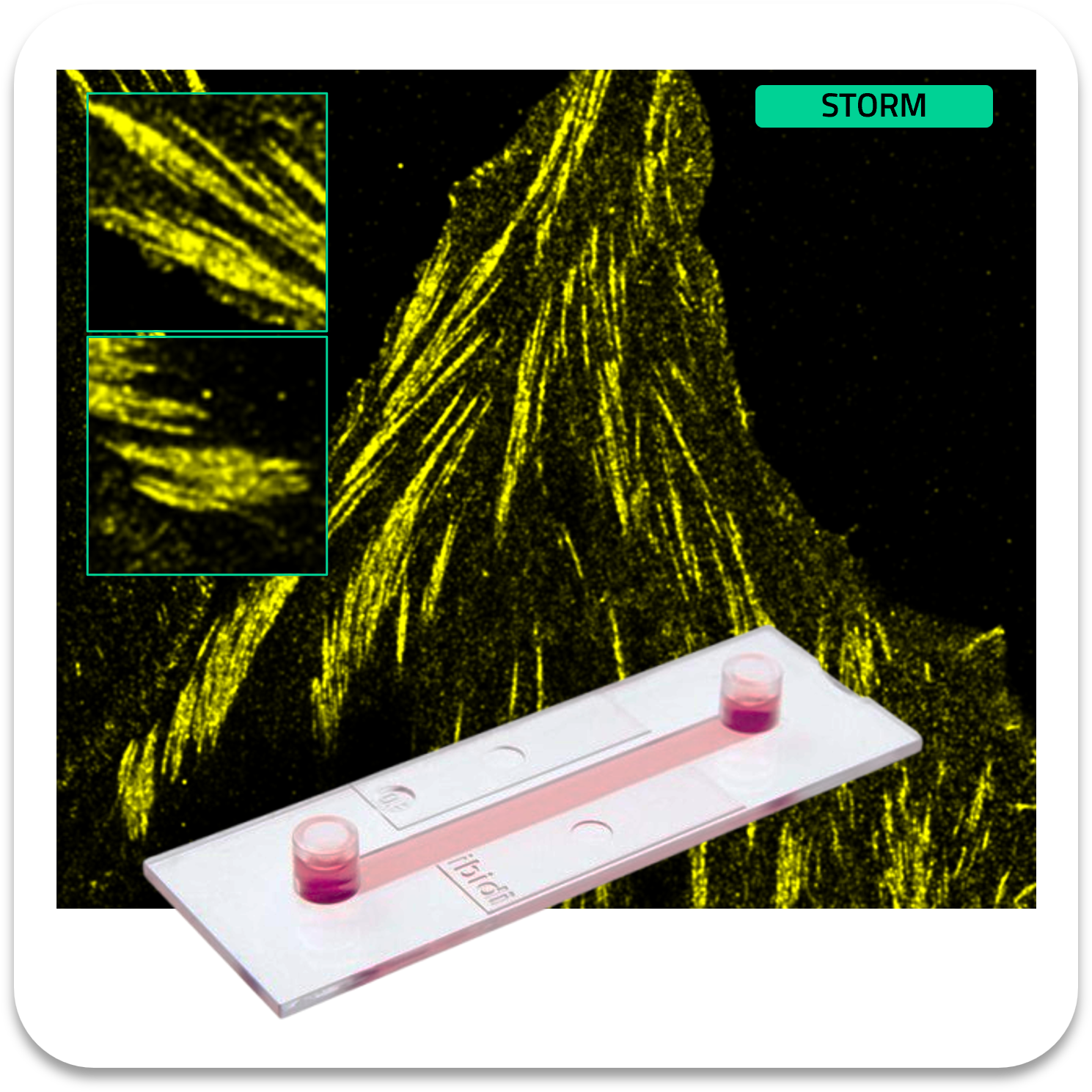 Abbelight safe sample paxillin af647